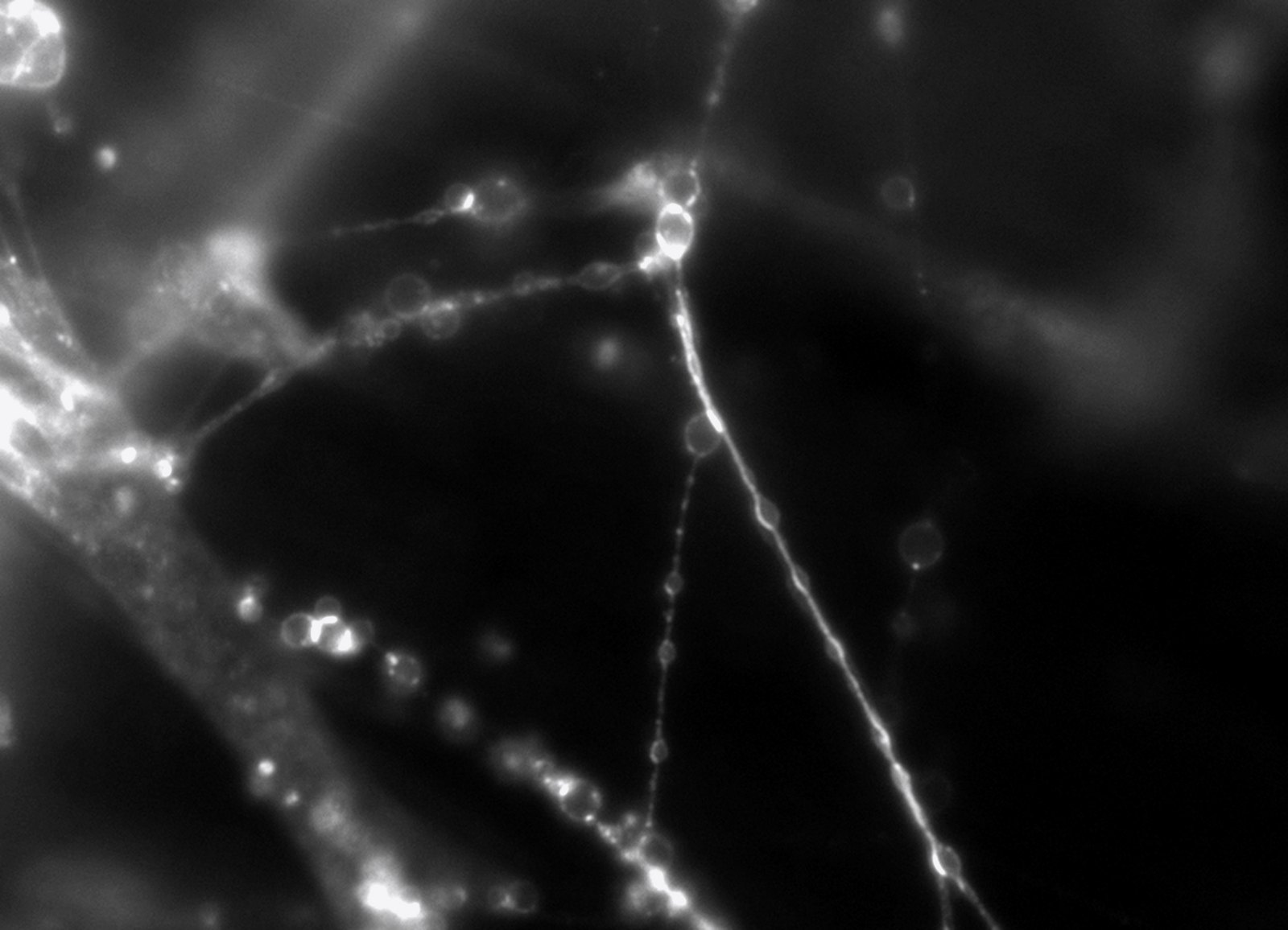 Cultured sensory neuron axons, fluorescence microscopy, black and white