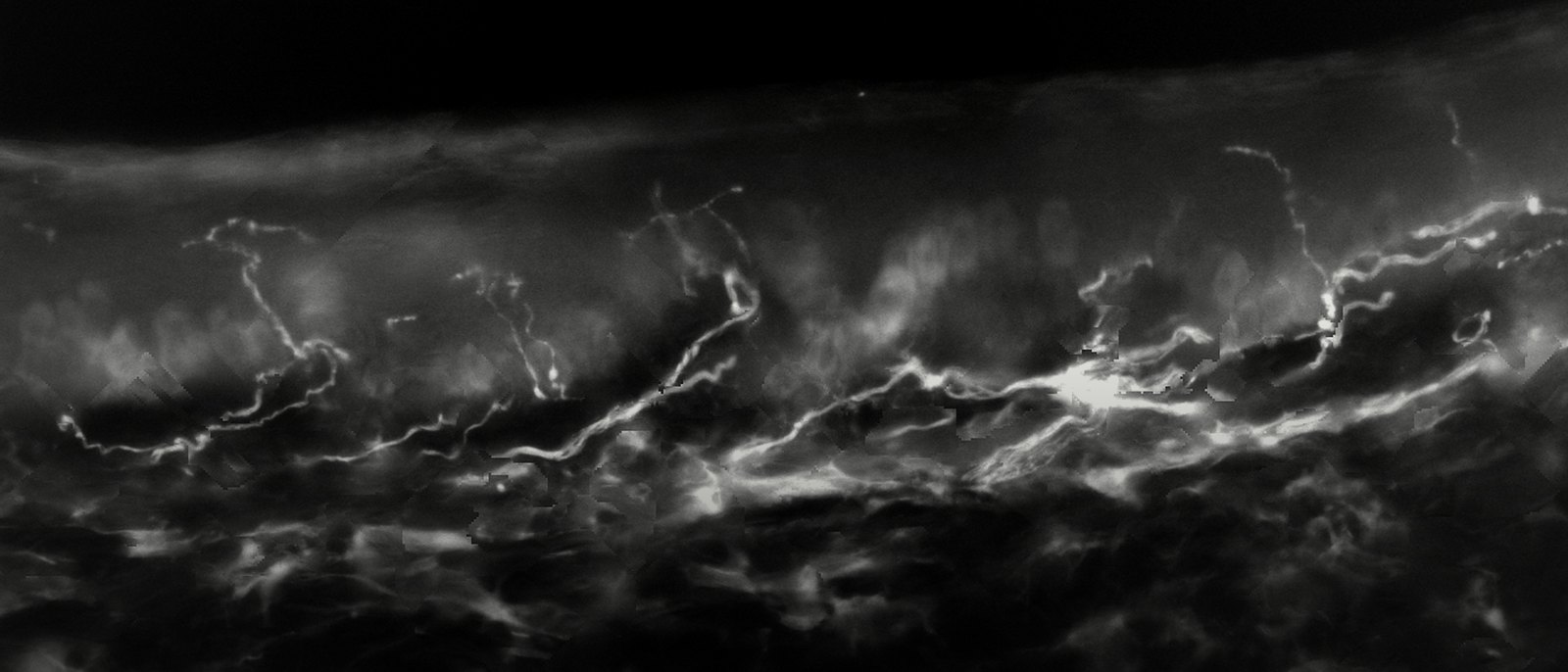 PGP9.5-stained skin section with nerve fibres crossing into the epidermis, black and white